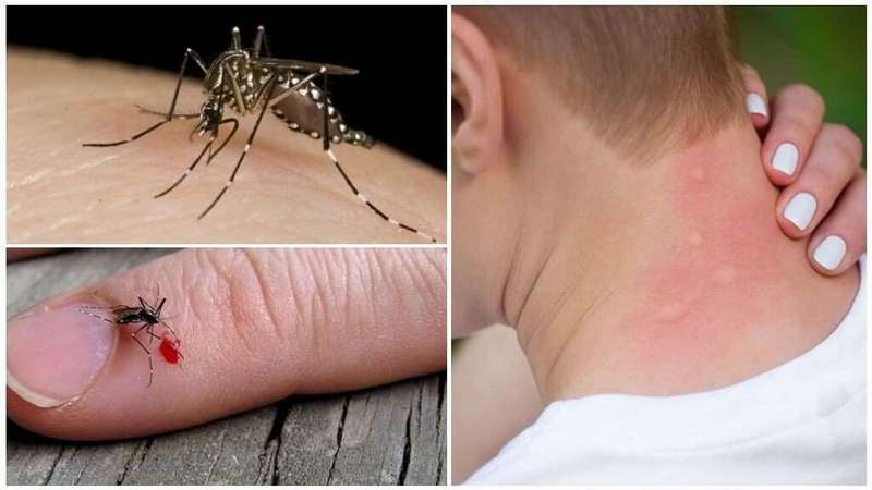 Ում են մոծակներն ավելի հաճախ խայթում