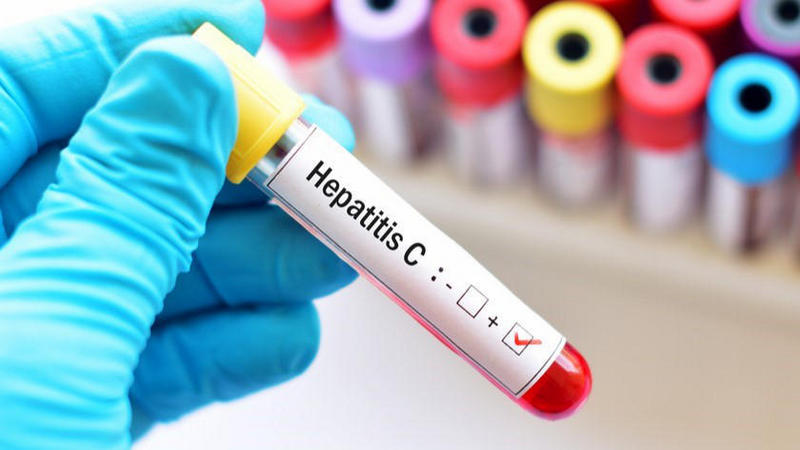 По данным ВОЗ, более 325 миллионов человек во всем мире заражены гепатитом B и C
