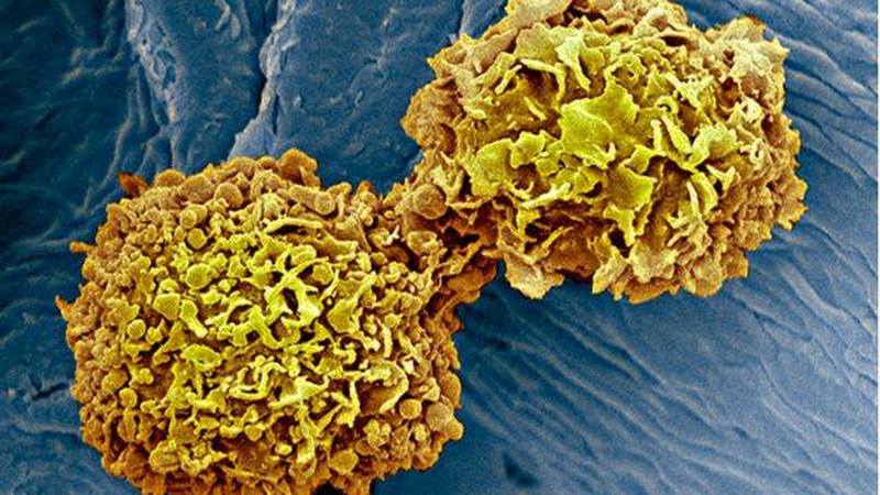 BBC — Ученые открыли универсальный анализ крови на рак